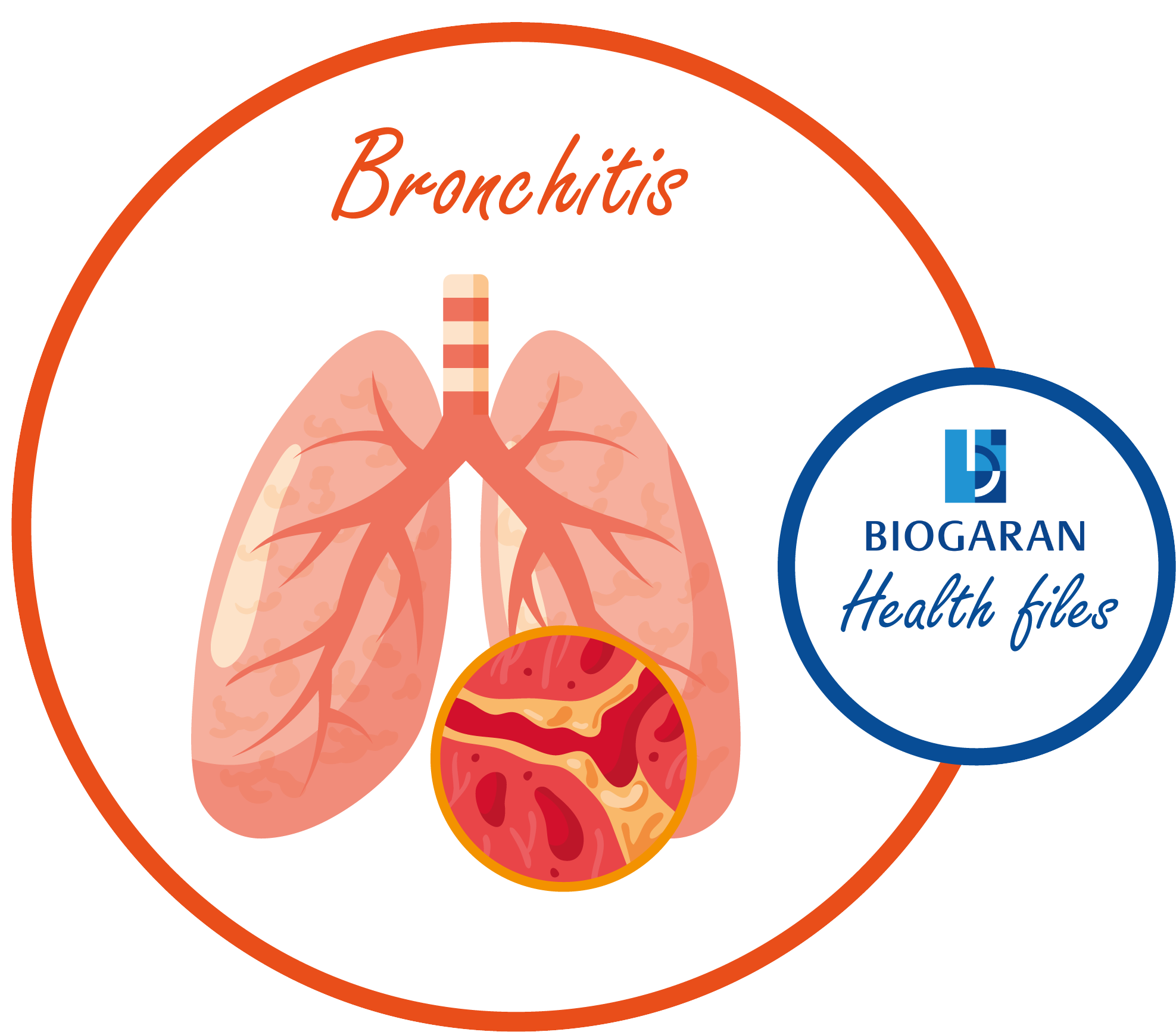 Understand Respiratory Infections 1 Bronchitis